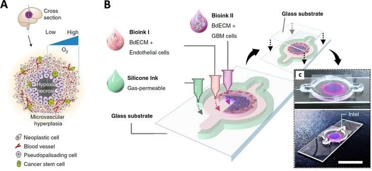 Fig_ 1_ GBM-on-a-chip. _ npj Precision Oncology