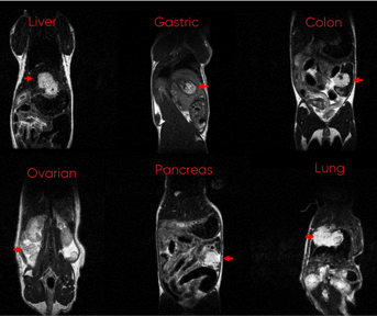 MRI-1