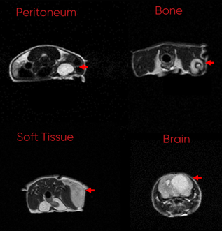 MRI-2