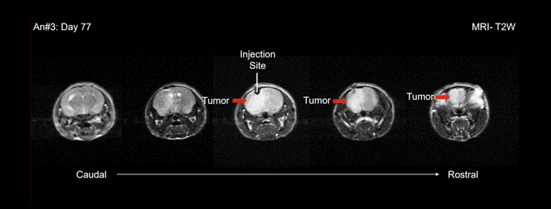 intracranial-inoculation-and-inhibition-via-MRI-optimized